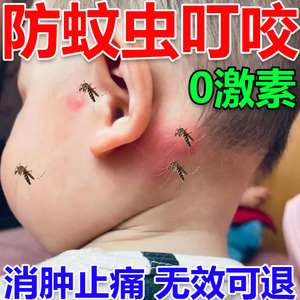 蚊虫叮咬快速止痒消肿婴儿宝宝儿童臭虫跳蚤叮咬止痒驱蚊药膏日本