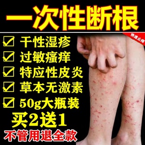 儿童特应性皮炎婴儿宝宝干性湿疹专用皮肤全身瘙痒外用止痒膏去根