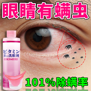 眼睛除螨洗眼液眼部专用眼药水维生素b12干涩发痒4松油醇去螨虫