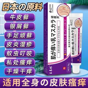 欢夫痒搭档抑菌乳膏正品廯痒藓痒止痒草本软膏皮肤外用大腿内侧