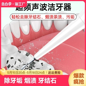 超声波洁牙器牙结石牙垢去除器牙齿洗牙神器美牙仪口腔镜清除牙石