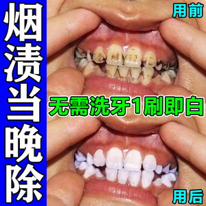 强力去烟渍牙膏去牙渍牙垢黄牙结石溶解牙石专用色素沉淀去除专用