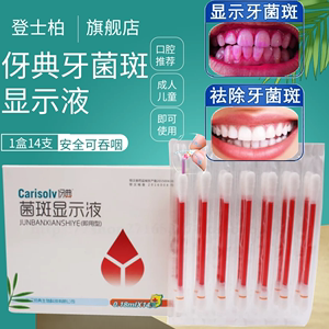 伢典牙菌斑显示液指示剂预防儿童蛀牙虫牙成人正畸口腔清洁牙结石