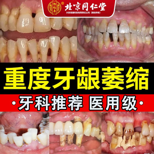 牙膏牙周炎口腔牙龈萎缩出血修复再专用生松动固齿抗敏医用脱敏治