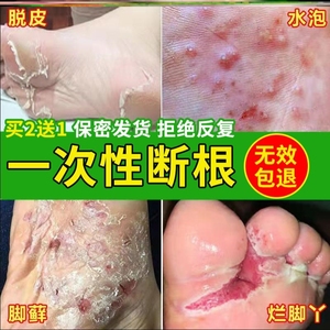 韩国脚气膏洗脚除臭肥皂脚痒水泡脱皮烂脚丫去臭膏日本脚臭味臭脚