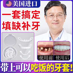牙套吃饭神器老人没牙仿真贴片男女牙齿缝填充缺牙齿防塞假牙缺牙