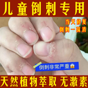 手指倒刺营养油儿童修复护理去手上长刺干裂脱皮神器膏指甲边缘霜