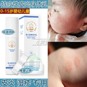 婴儿童特应性皮炎身体乳湿疹专用宝宝止痒去根干燥保湿润肤面霜膏