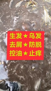 生发乌发去屑防脱控油止痒脱发白发头屑头油头痒潘婷海飞丝飘柔沙