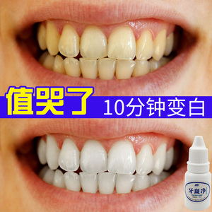 美白牙齿快速烟牙菌斑牙垢黑渍洗牙粉液去黄牙牙贴牙膏神器白牙