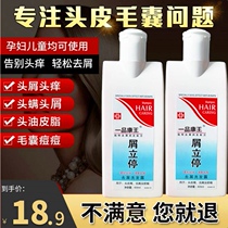 Kangwang anti-dandruff anti-itch shampoo buster anti-dandruff artifact Serious itch control oil dandruff shampoo cream for men and women