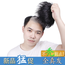 Mens Hair Patch Wig set Overhead hair patch Forehead baldness Hair patch Hair extension Clamshell wig Real hair Male hair block
