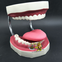 Dental Department of Stomatology dental model kindergarten childrens English teaching brushing 6-fold magnification with tongue teaching aids