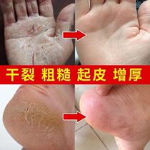(Buy 1 get 1 free) Hands and feet dry skin peeling rough heel crack crack cream Anti-crack chapped crack healing