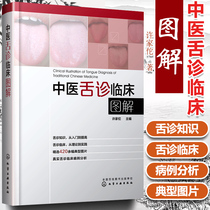 Genuine Chinese medicine tongue diagnosis Clinical illustration of tongue image Diagram of normal and abnormal tongue image Illustration of tongue diagnosis disease Introduction to Chinese Medicine books Self-study Basic Chinese medicine health
