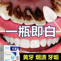 Removal of calculus dissolving calculus quick-acting tooth cleaning tartar removal tooth cleaning artifact remover