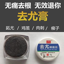Snaw Thorn monkey remove foot soles plantar warts special cream corns calluses to Root artifact warts wart