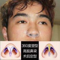 Nasal septum deviation Nostril aligner Nasal brace Nasal clip dilator Post-rhinoplasty postoperative styling support Silicone