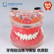 Dental oral teaching model periodontal bing model practice curettage calculi practice stone curettage