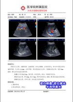 Porcelain white A4 color inkjet laser film paper gastroscopy pathology B superfour-dimensional color superhospital with print film