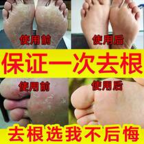 Yellow skin Wormwood Australian fungus king ginger this herb antibacterial calluses sulfur scrub beriberii anti-itching and tinea pedis cream
