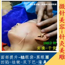 Acupuncture Beauty Microneedle Beauty Sculpture Facial Body 2019 Dry Goods Share 180 Discrewed and dispel eye bags Black Eye Circle