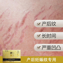 Japan Yihe Stretch mark repair cream Stretch marks postpartum elimination of fat lines Dilute growth lines repair special light