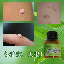 Remove the monkey spirit ointment to remove the water monkey meat thorns the skin of the creature the calluses the chicken eye ointment