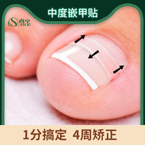 Moderate nail nail nail groove nail nail long meat pull toe nail nail nail inflammation patch hook