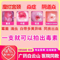 Baiyunshan Shouyin Liquid Vaginal Detoxification Gynecological Anti-inflammatory Antibacterial Gel Women Compact Private Cervical Erosion Medication