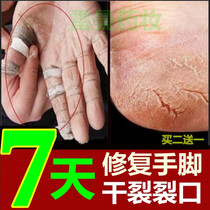 Dry heel peeling skin anti-cracking chapped cream to cure hands and feet crack mouth special effect elderly horse oil hand cream snake oil
