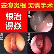 Yuanyang Four Seasons Rhinitis Ointment Pure Chinese Medicine Miaojia Goose Not Eating Sinusitis Nasal Sinusitis Anti-allergic Biyan Ointment