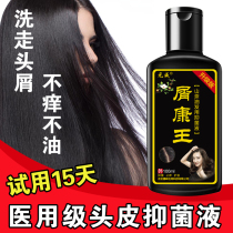 Kang Wang anti-itching and anti-dandruff shampoo Dew medicine to dandruff serious nemesis anti-fungal mite anti-mite artifact