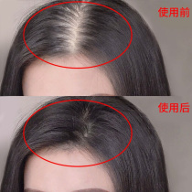 (Li Jiaqi recommends buy 2 get 1 free) Hair natural growth rate becomes dense and Changsheng ginger shampoo soap