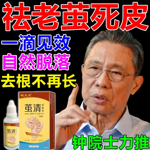 Ноги ногти, чтобы устранить каллиграфические ноги кокон кокон -ноги мертвые мягкие мягкие -крема -очень