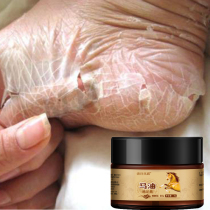 (Buy 1 get 1 free buy 2 get 3 free)A touch to restore tender and smooth heels feet feet feet feet feet feet feet feet feet feet feet feet feet feet