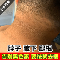 Neck black acanthosis children remove melanin precipitation neck wash not clean whitening axillary femoral obesity remove joints