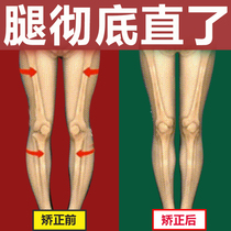 (Beautiful leg artifact)xo type leg calf valgus circle leg corrector Inner eight straight leg artifact student