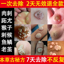 Treatment of warts meat pimples hands and feet removal of monkey feet monkey medicine meat thorns cream wart root