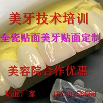 Porcelain Veneers All-ceramic Veneers Ice Porcelain Veneers Yijia Porcelain Veneers Amber Porcelain Veneers Beauty Salon All-porcelain Veneers