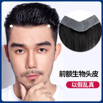 Wig patch Male head patch Hairline wig patch Real hair Forehead incognito fake bangs Invisible wig patch