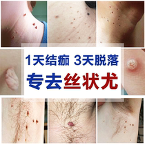 5G filamentous wart remove small pieces of meat neck small meat ball imiquine meiquine Ointment Cream 5% flat warts