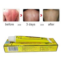 Body Psoriasis Cream Perfect For Dermatitis and Eczema Pruri