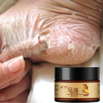 (Buy 1 get 1 free Buy 2 get 3 free) Foot steam buster~chapped moisturizing moisturizing foot cream a touch to restore the heel