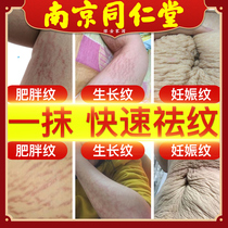 Nanjing Tongrentang pregnant women postpartum removal of stretch marks repair cream to eliminate prevention of tightening and obesity pregnancy care