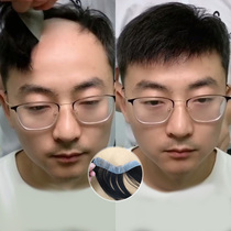 Mens hairline wig invisible unscathed forehead bald M-shaped cover high forehead real hair silk reissue block