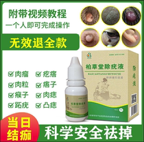 Wart remover meat lump warts to Monkey Point wu zi