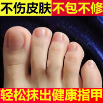 Damaged nail thickening repair concave-convex growth solution nail repair solution regeneration nutrient oil finger toenail rebirth