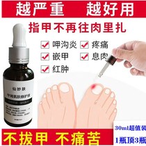 (Large package 30ml)Treatment of embedded armor analgesic A groove pain elimination granulation walking nail tie meat fairy Miao skin