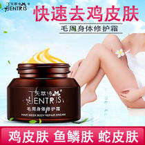 Herbal to remove chicken skin to fish scale mole snake skin cream moisturizing and moisturizing chicken skin savior goose bumps body milk